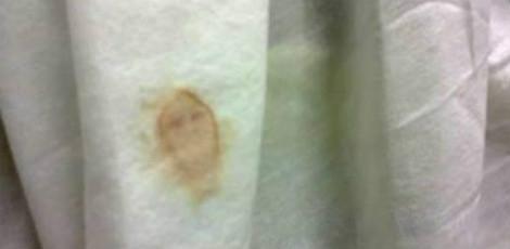 Funcionários garantem que a imagem formada pelo sangue é de Nossa Senhora de Fátima / Foto: Reprodução/Facebook