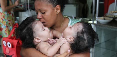 Mãe dos gêmeos acaricia os rebentos durante consulta no Imip / Foto: Guga Matos/JC Imagem