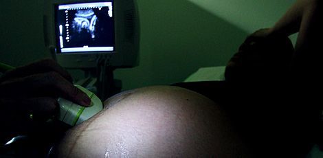 Médicos informam que as gestantes têm manifestado muita ansiedade durante ultrassom