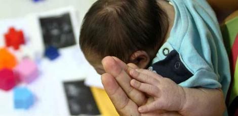 Especialistas percebem mais casos de bebês com microcefalia que têm disfagia (dificuldade de deglutição com risco de broncoaspiração) / Diego Nigro/JC Imagem