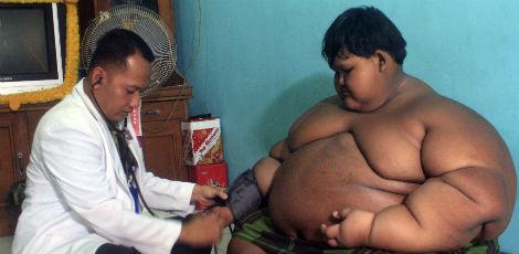 Arya nasceu com peso normal, porém, a partir dos dois anos, começou a ganhar quilos de forma descontrolada / Mahendra/AFP