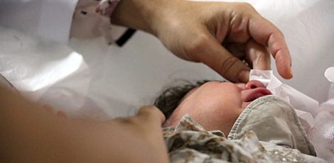 Maria Luísa, de 5 meses, passa por uma série de exames para avaliar o grau comprometimento ocular 